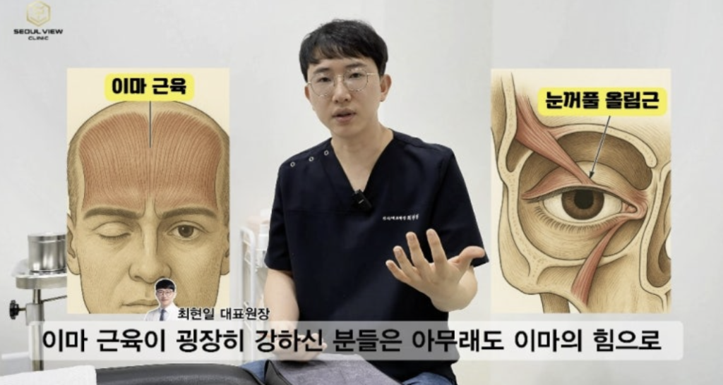 세종 나성동 이마보톡스 시술 시 주의해야 할 전두근(Frontalis)의 위치와 눈썹 들림 원리 설명 이미지