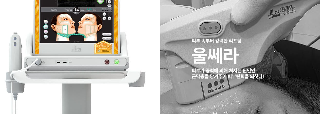 유스앤영서울뷰의원 리프팅 울쎄라 장비