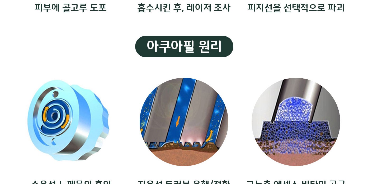 유스앤영서울뷰의원 메디컬 스킨케어 아쿠아필 원리