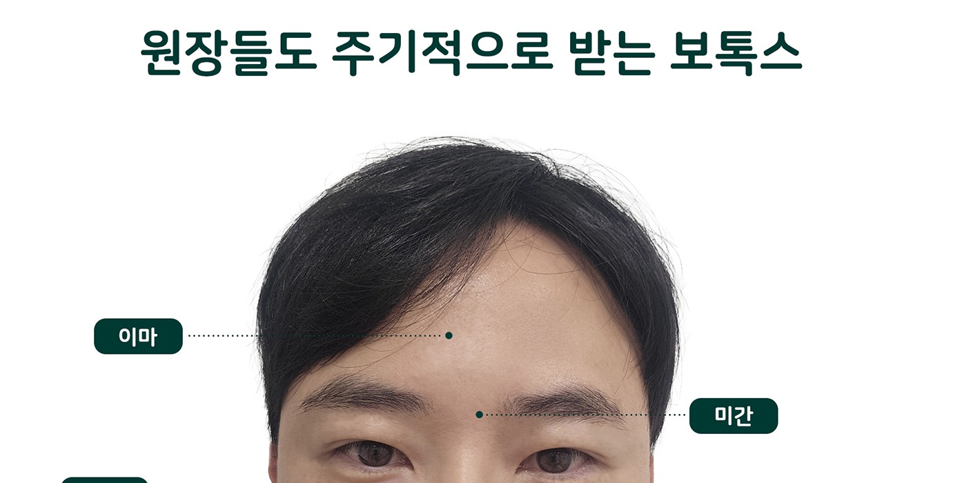 유스앤영서울뷰의원 보톡스/필러/윤곽 보톡스 시술 부위